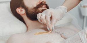 men hair removal Naples FL